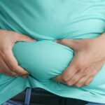 How Non-Invasive Fat Reduction Techniques Are Shaping Cosmetic Trends
